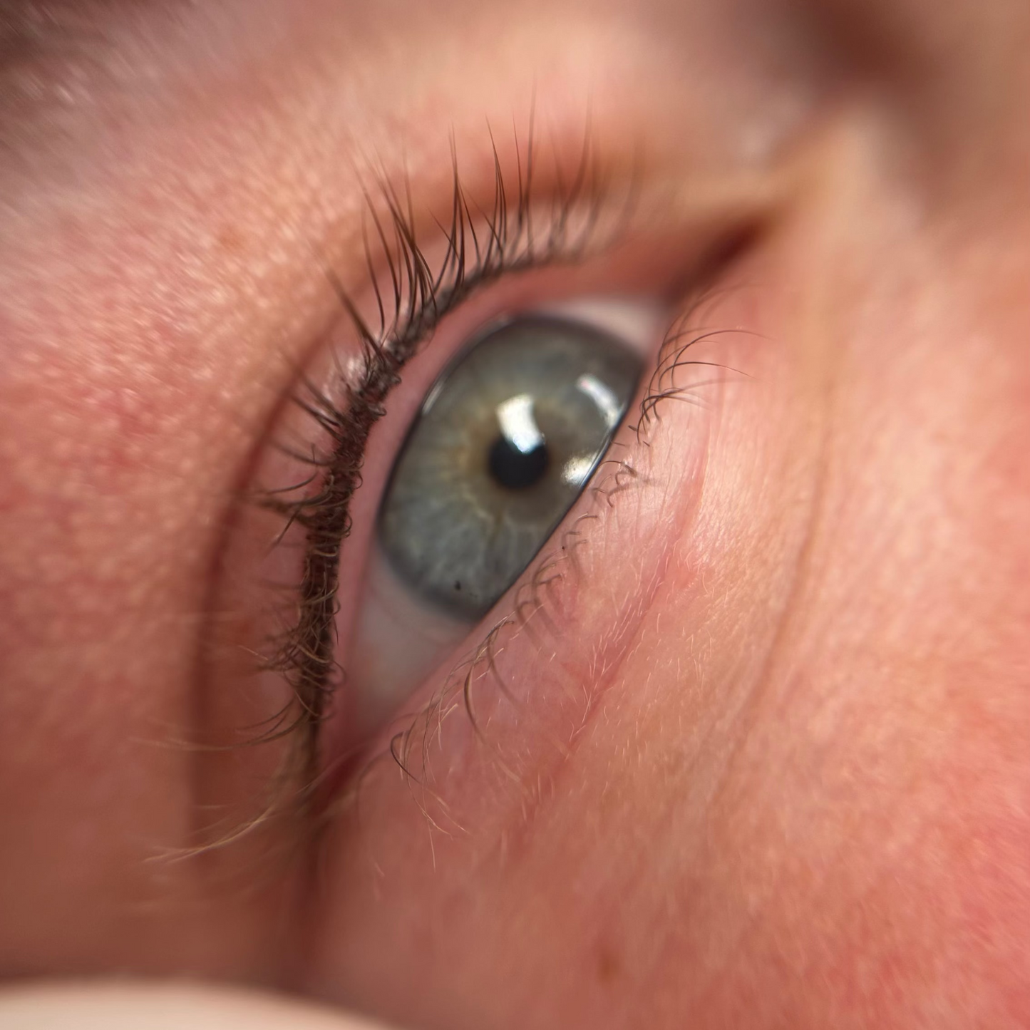 Masterclass Wimpernkranzverdichtung