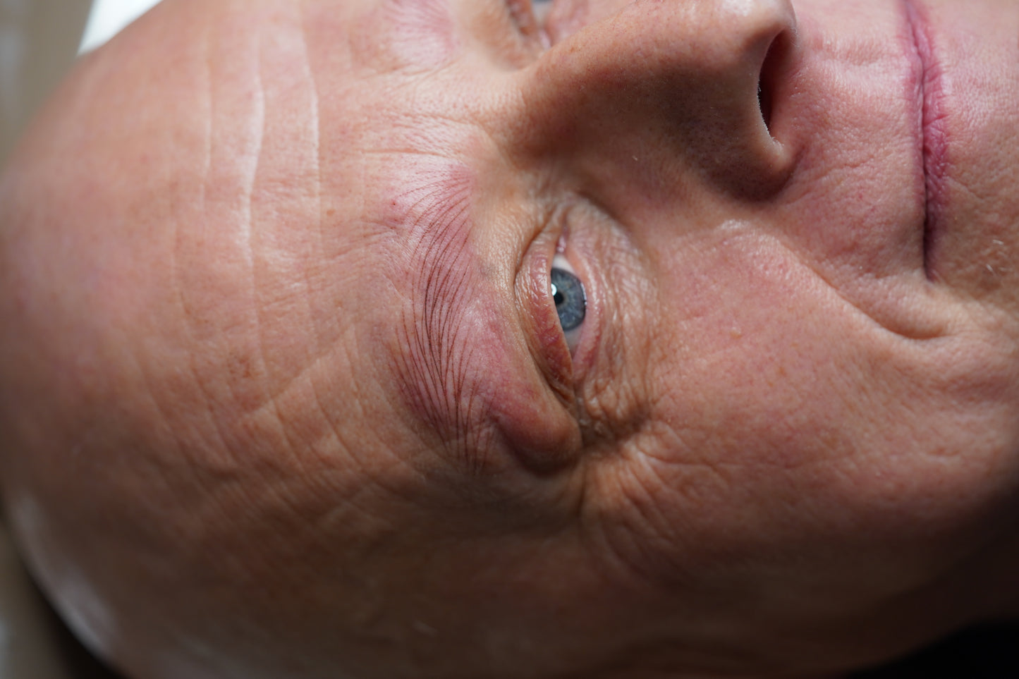 Alopezie Male-Brows Hairstroke