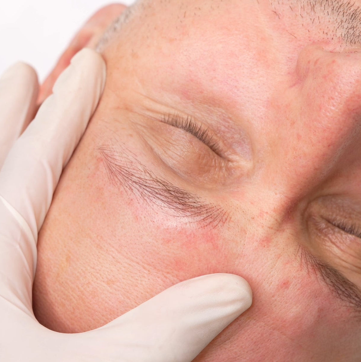 Malebrows Behandlungsvideo
